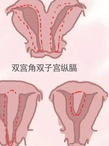 三代试管婴儿有什么弊端？看完就清楚了!