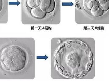 切除卵巢囊肿会影响生育吗？切除卵巢囊肿有哪些危害？